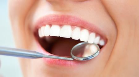 Clínica Dental Arucas dientes blancos